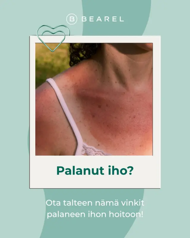 ☀️ Liikaa aurinkoa? Jos iho tuntuu kuumottavalta tai punoittaa auringossa olon jälkeen, oikeanlainen jälkihoito voi auttaa rauhoittamaan ihoa ja tukemaan sen kosteustasapainoa. 

Katso vinkit auringon rasittaman ihon hoitoon ja tallenna julkaisu myöhempää käyttöä varten. ✨

Muista myös, että paras tapa suojata ihoa on ennaltaehkäisy: käytä aurinkovoidetta riittävästi, lisää sitä päivän aikana ja vältä liiallista auringolle altistumista erityisesti keskipäivällä. ☀️

#bearel #ihonhoitovinkit #ihonhoito #kbeauty